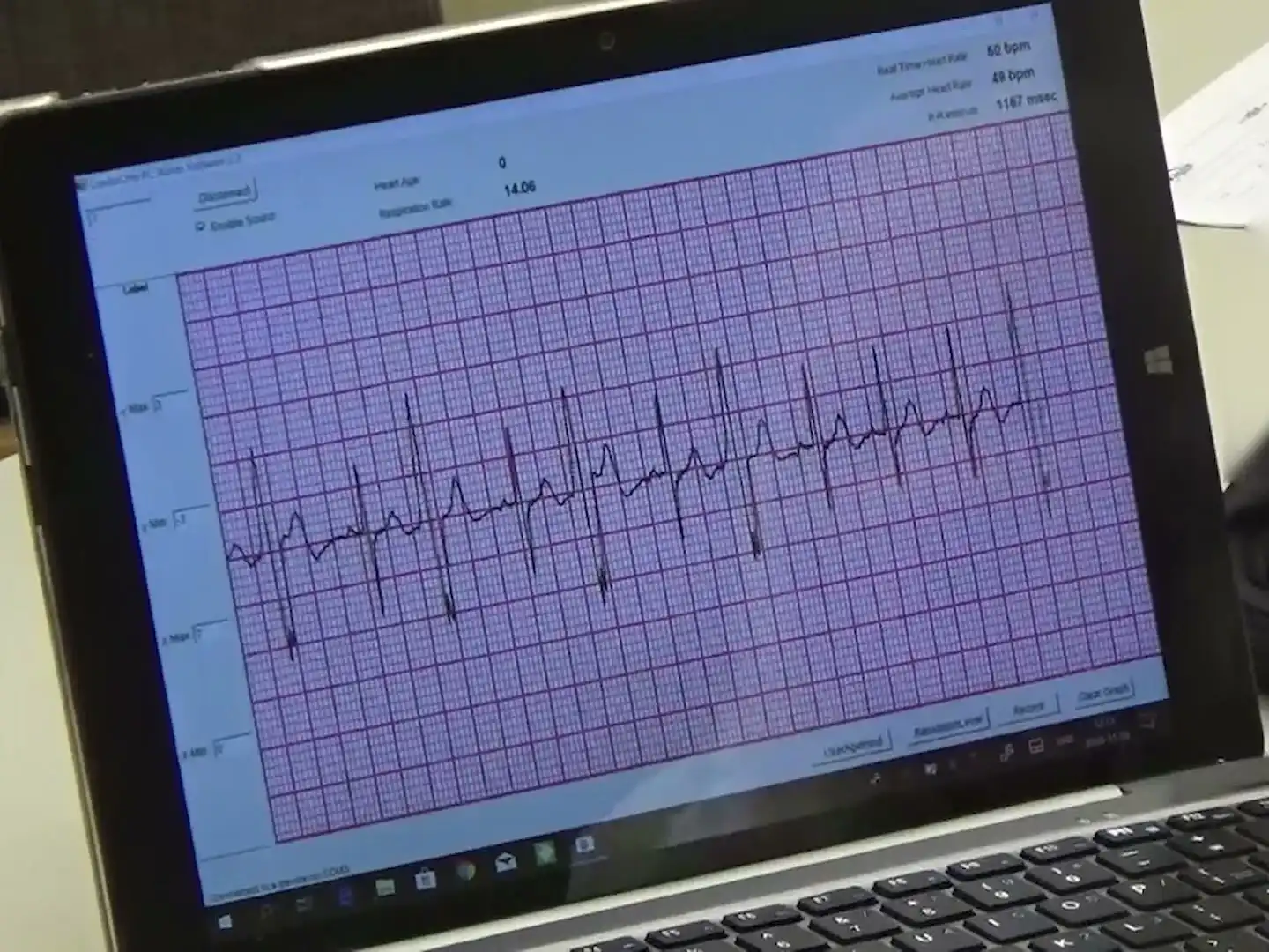 Viselhető szenzor élő EKG-görbéje egy táblagépen