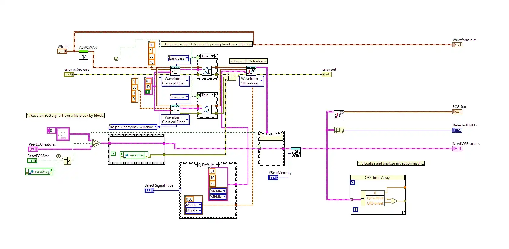 Az EKG-szűrés és a jellemzőkinyerés LabVIEW-blokkdiagramja